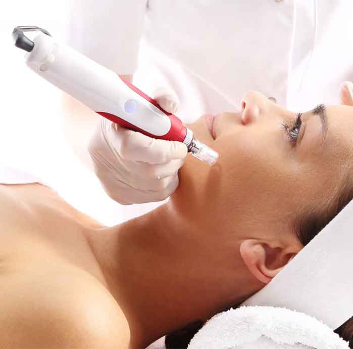 best acne scar treatments