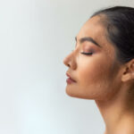 Acne Scar Treatment