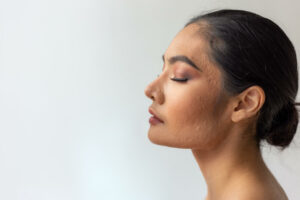 Scar Healing Stages: How Scars Heal and When to Support Your Skin