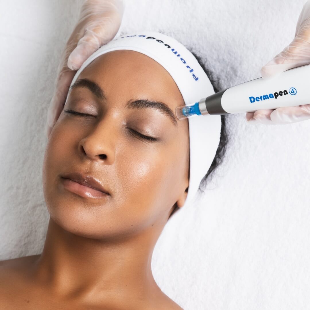 dermapen-4-skin-needling-treatment-3 What Makes Our Treatment Different?