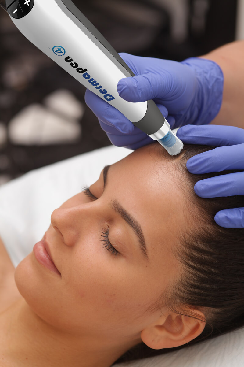 Dermapen 4 Microneedling Treatment in Perth